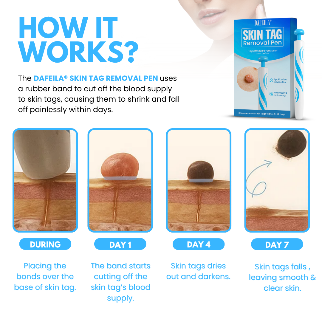 Dafeila® Skin Tag Removal Pen_Ultra02