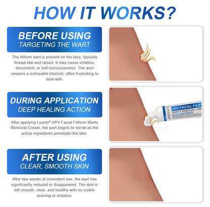 LYYETO® HPV Facial Filiform Warts Removal Cream