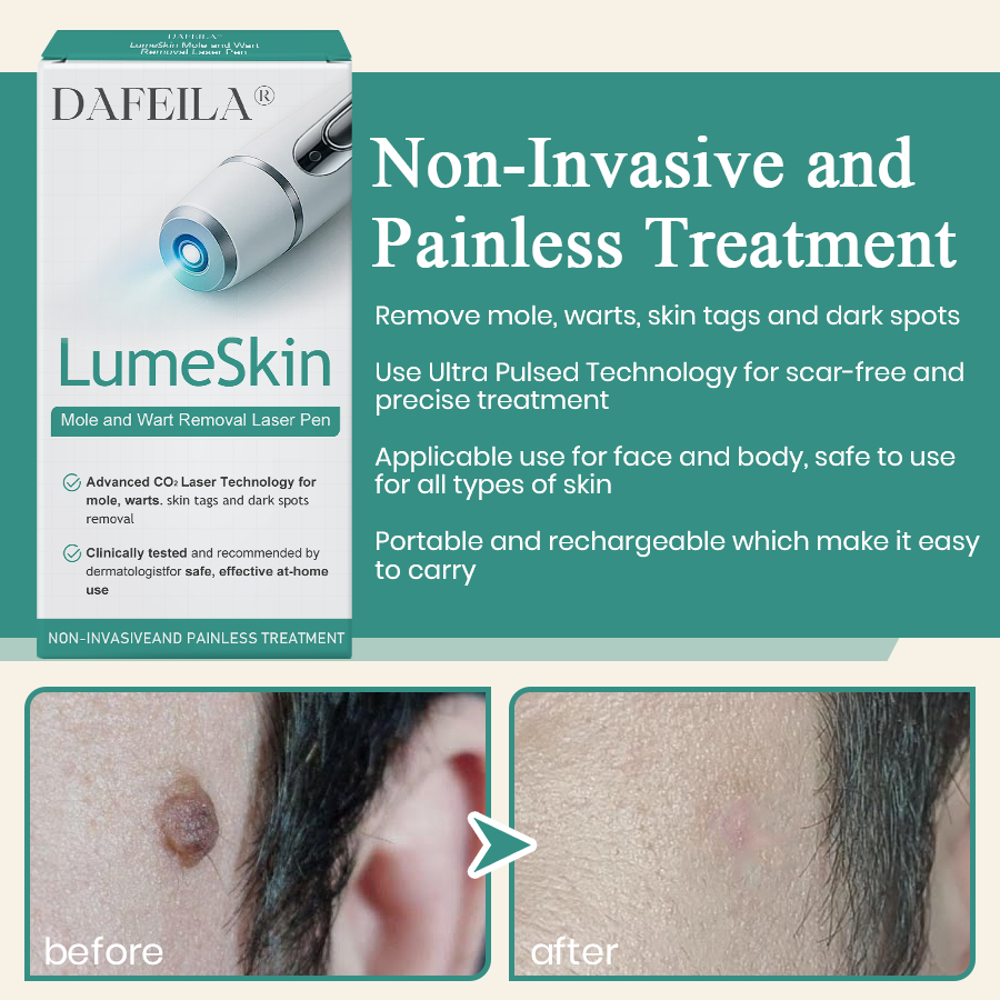 DAFEILA® LumeSkin Mole and Wart Instant Removal Laser Pen_Ultra01