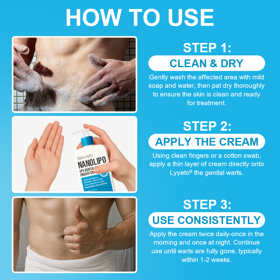 LYYETO® NANOLIPO HPV GENITAL WARTS ERASER CREAM ACE 4