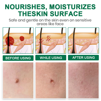 Lyyeto® Herdle Shot Spot & Mole Correct Serum ACE