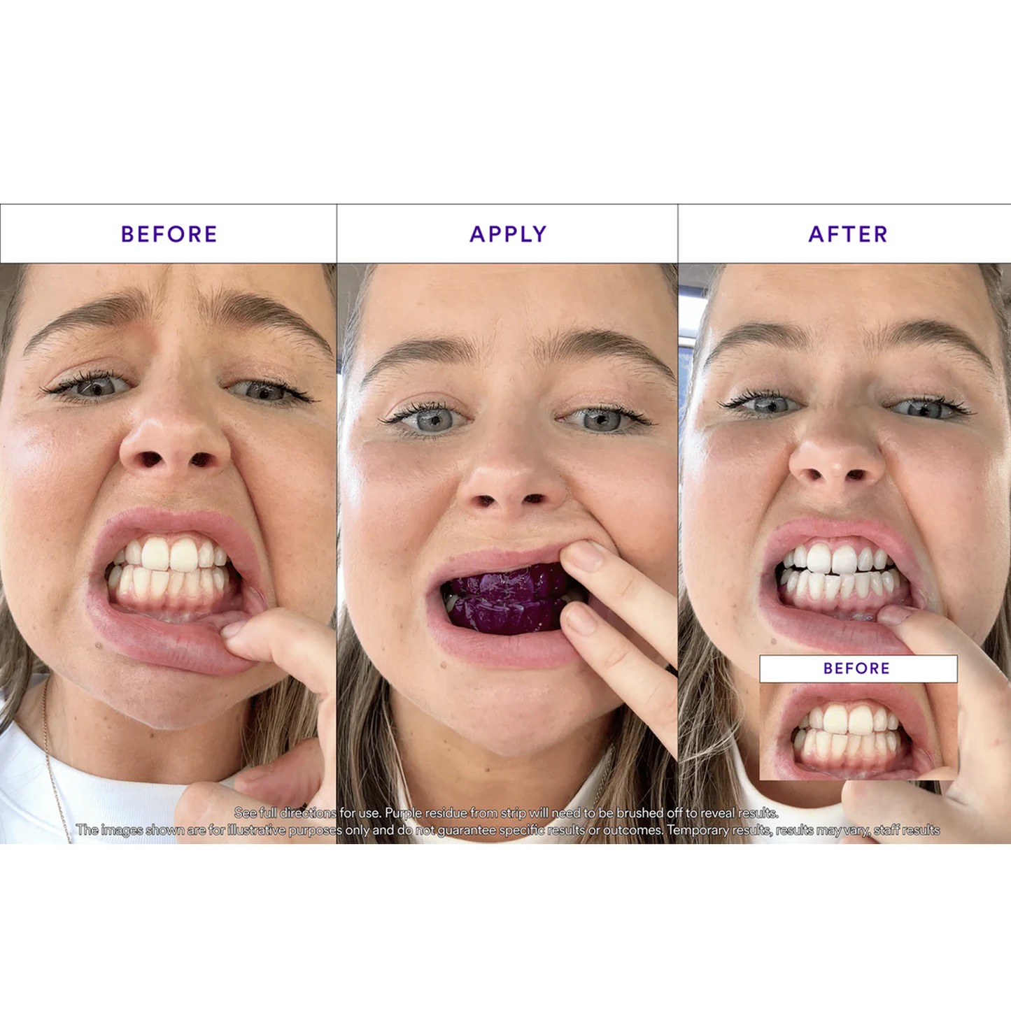 V34 Whitening Strips_Ultra01