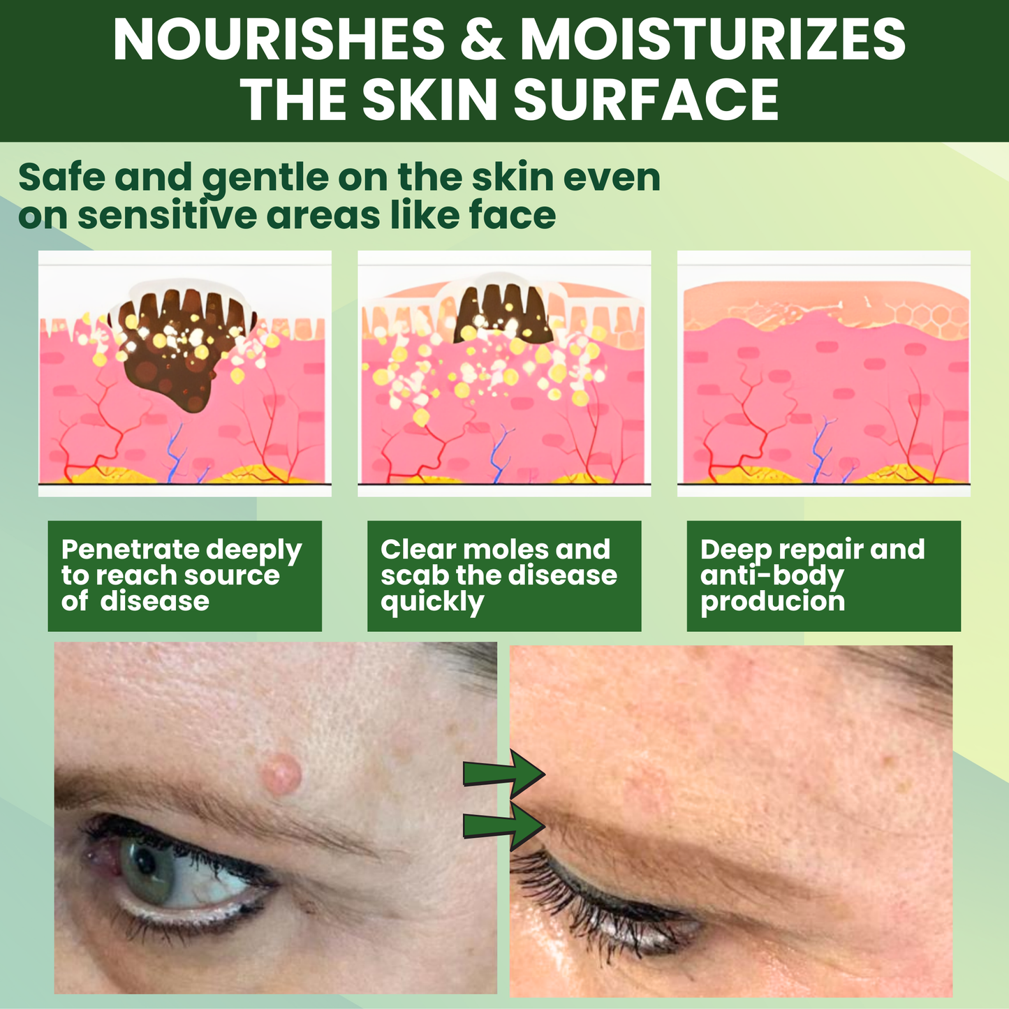 Luhaka® Reedle Shot 100 Tag & Spot Target Advanced Serum ACE