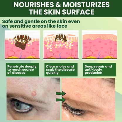 Luhaka® Reedle Shot 100 Tag & Spot Target Advanced Serum ACE