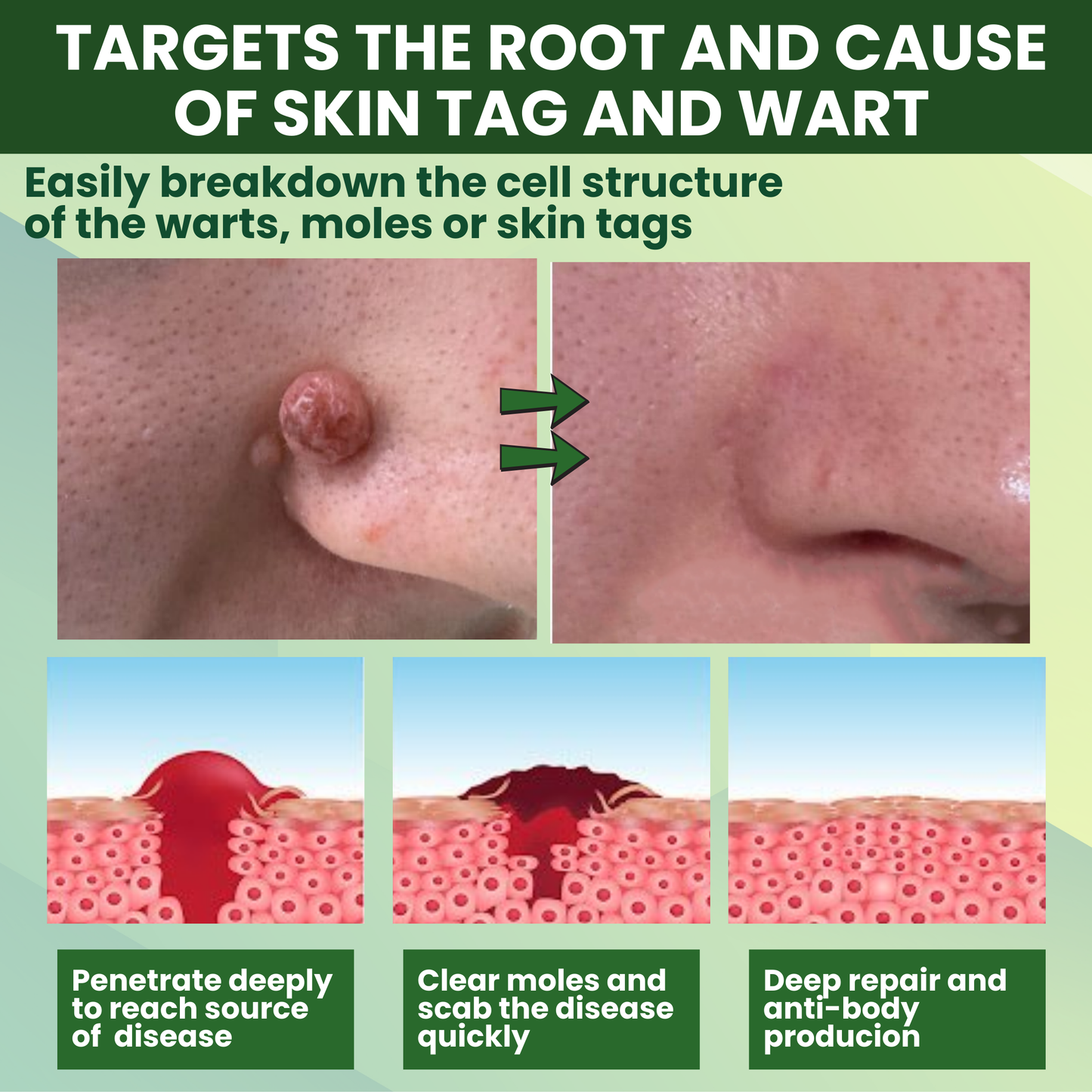 Luhaka® Reedle Shot 100 Tag & Spot Target Advanced Serum ACE