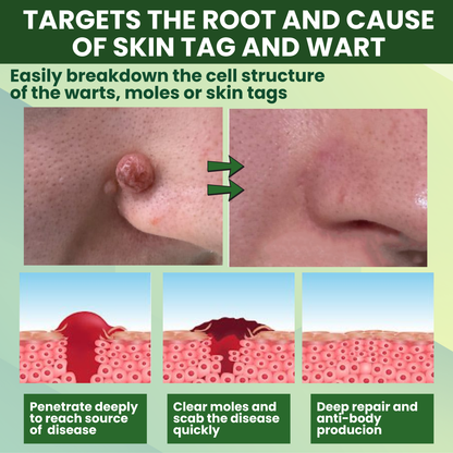 Luhaka® Reedle Shot 100 Tag & Spot Target Advanced Serum ACE