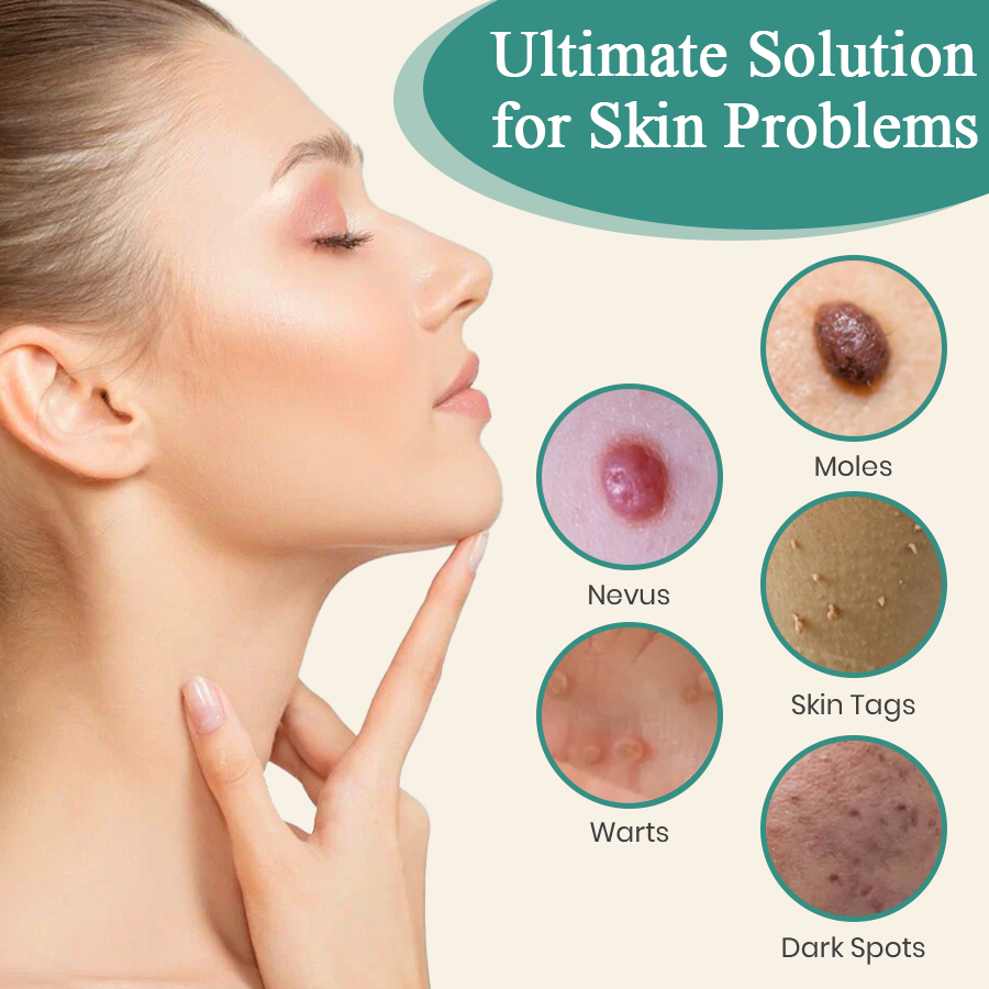 DAFEILA® LumeSkin Mole and Wart Instant Removal Laser Pen_Ultra01