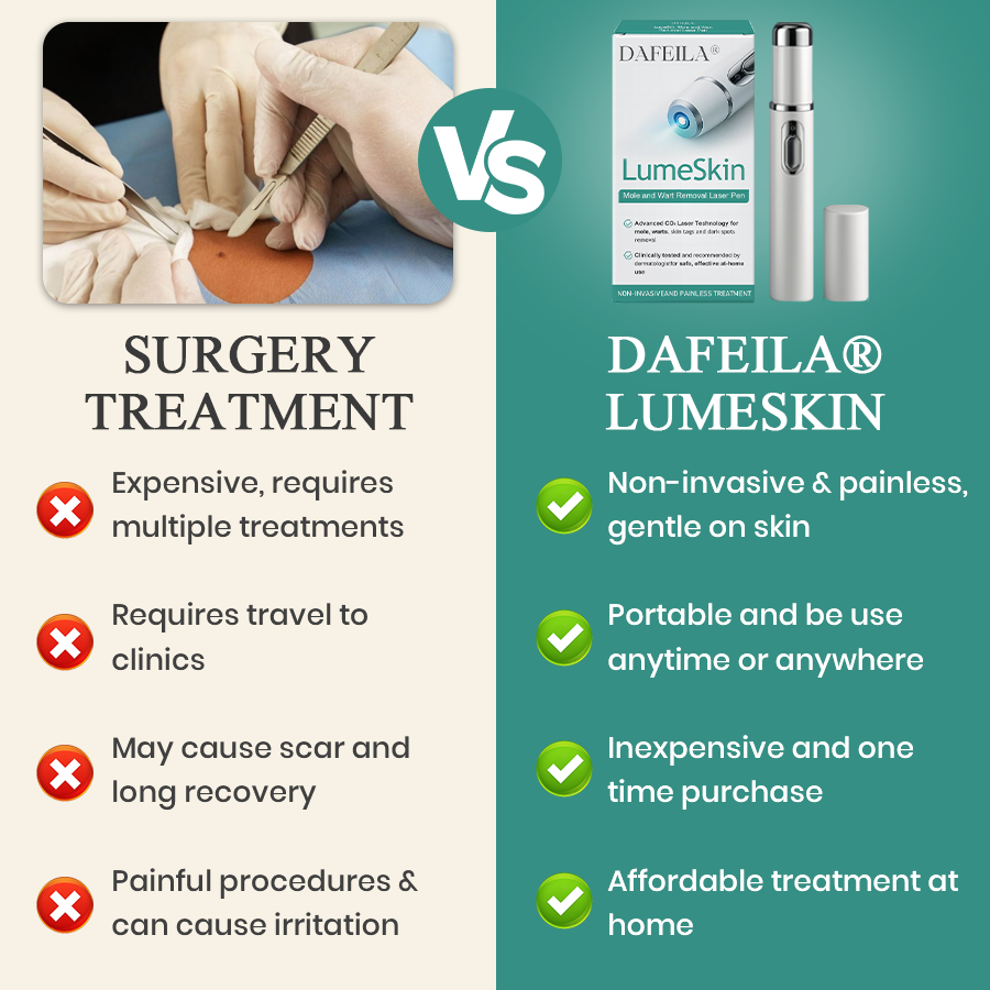 DAFEILA® LumeSkin Mole and Wart Instant Removal Laser Pen ACE 10