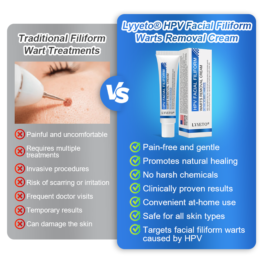 LYYETO® HPV Facial Filiform Warts Removal Cream