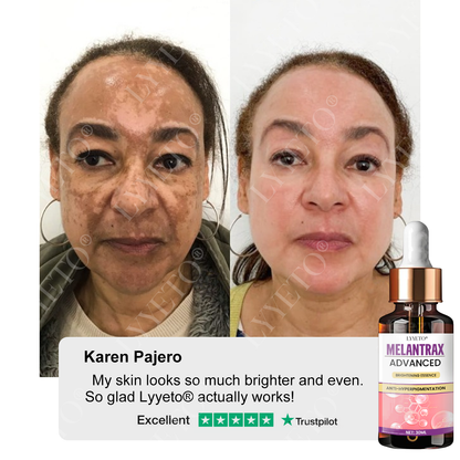 Lyyeto® MelantraX Advanced Brightening Essence 🏆