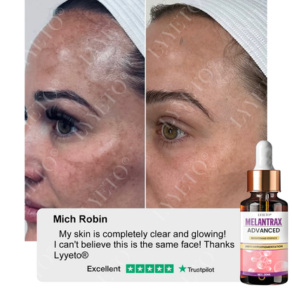 Lyyeto® MelantraX Advanced Brightening Essence 🏆