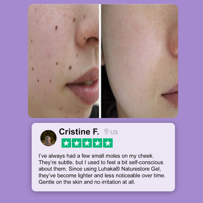 Luhaka® Naturestore Wart and Mole Removal Gel 🌟