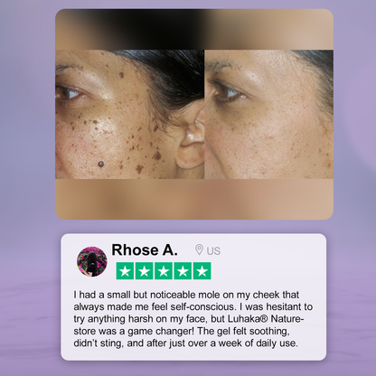 Luhaka® Naturestore Wart and Mole Removal Gel 🌟