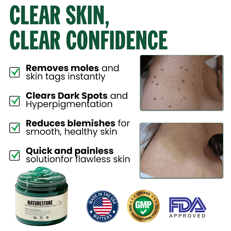 Luhaka® NATURESTORE Instant Mole & Spot Gel