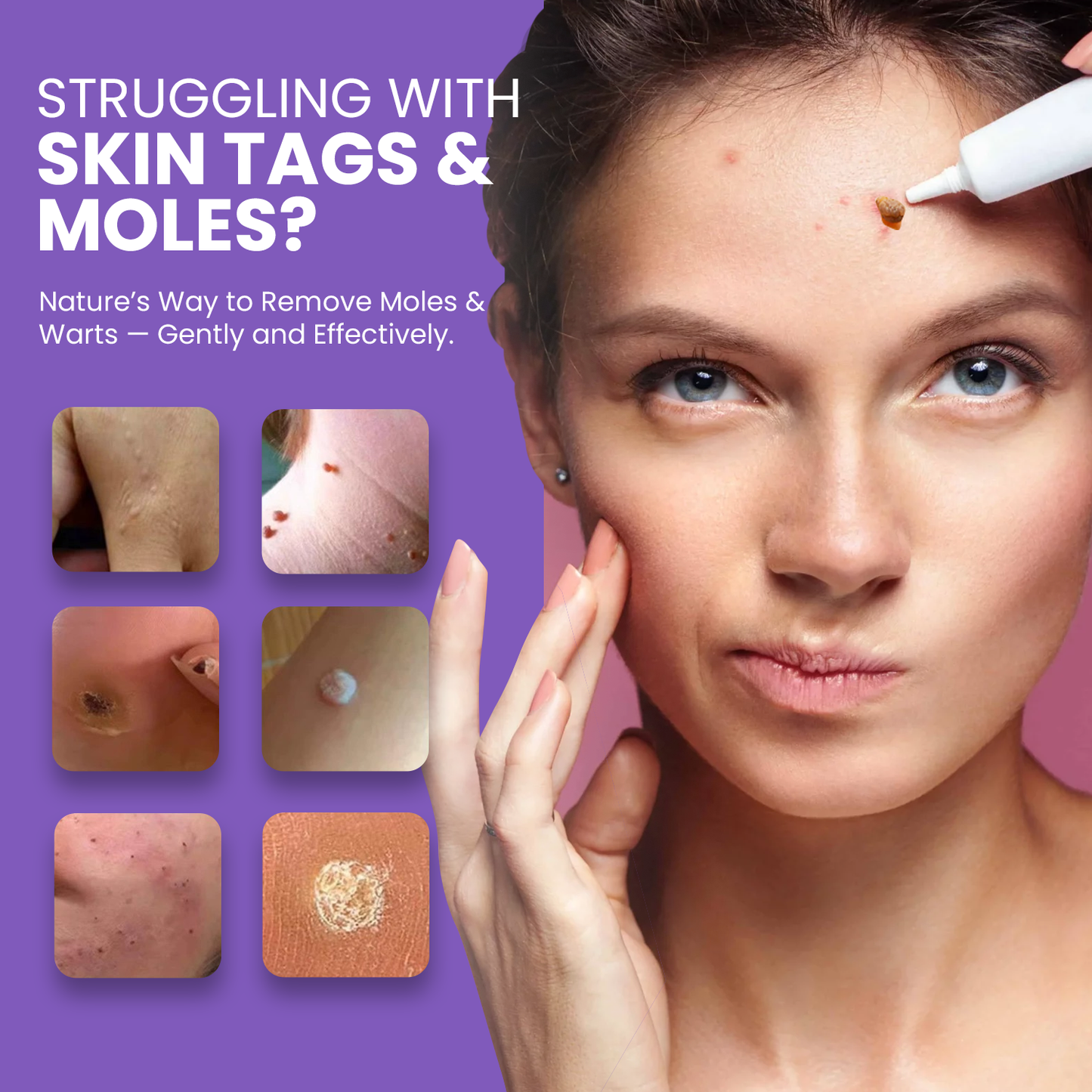 Luhaka® Naturestore Wart and Mole Removal Gel 🌟