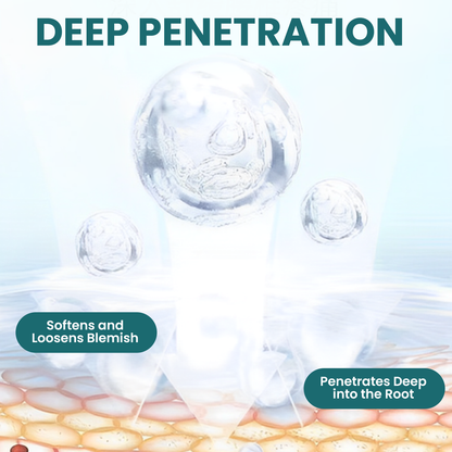 Luhaka® Naturestore Mole and Wart Removal Gel_Ultra02