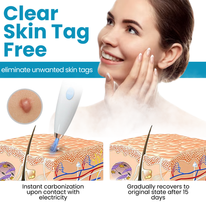 Dafeila® Shot Erase Pro 💎 1