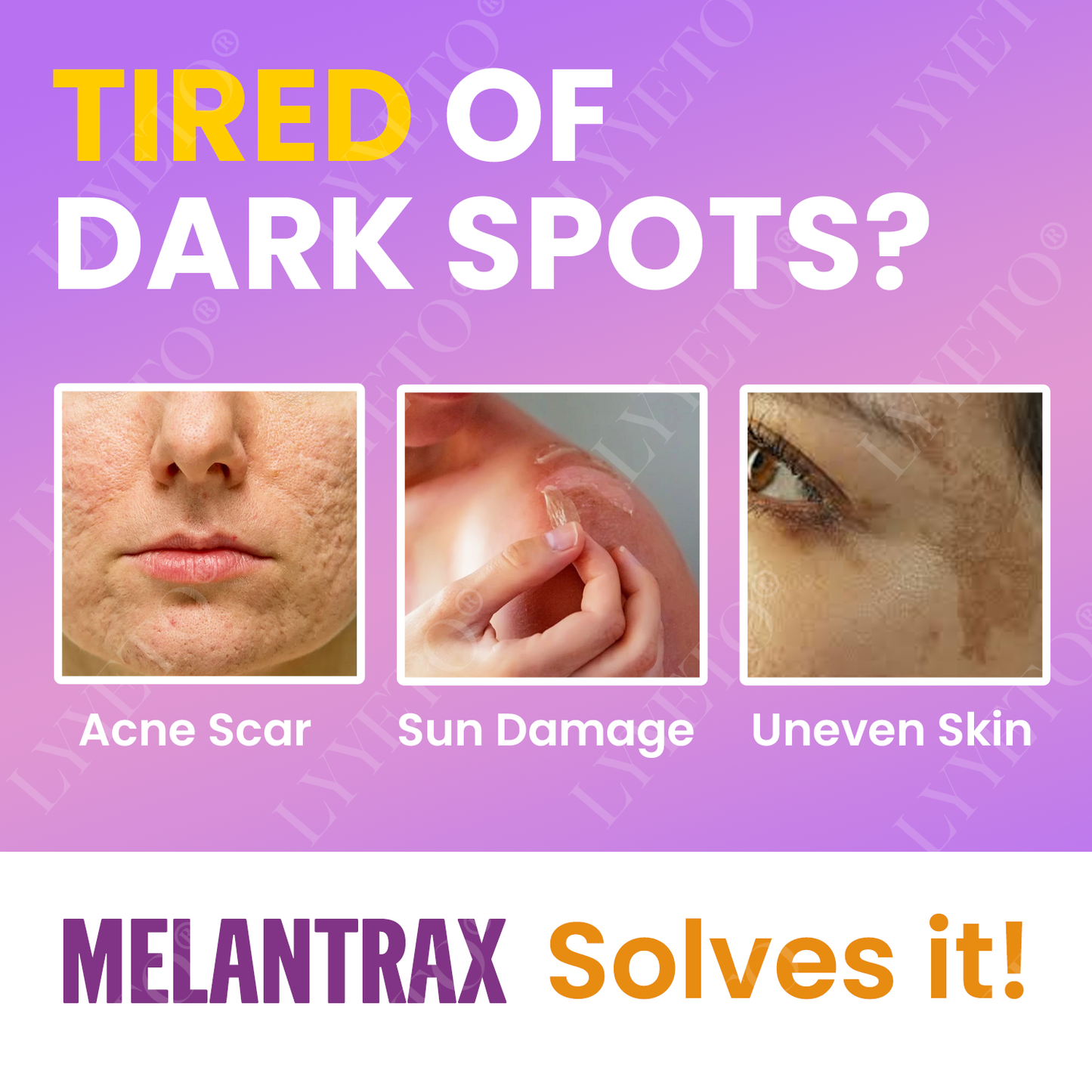 Lyyeto® MelantraX Advanced Brightening Essence 🏆