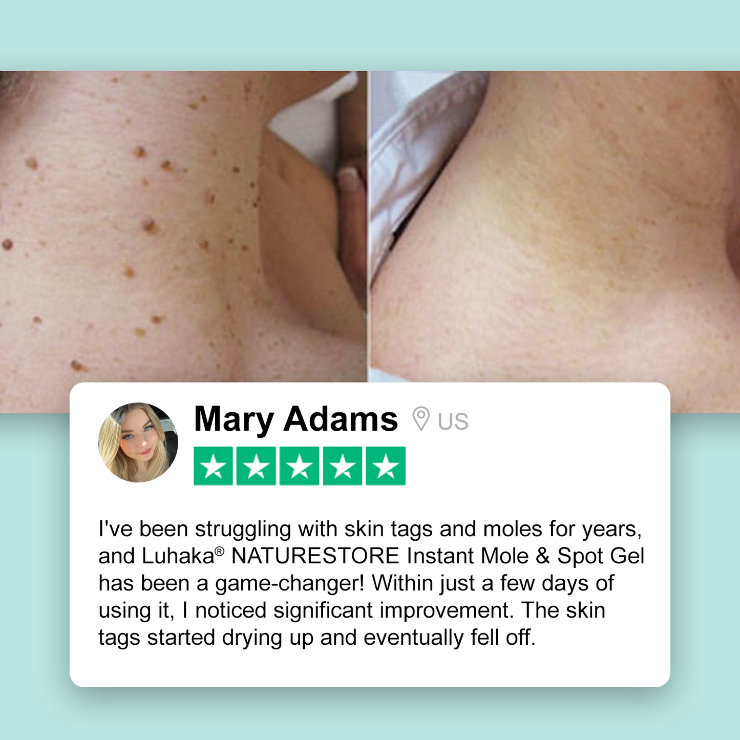 Luhaka® NATURESTORE Instant Mole & Spot Gel