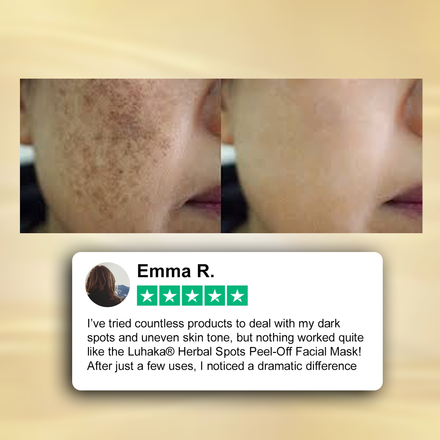 Luhaka® Herbal Spots Feel-off Facial Mask 2