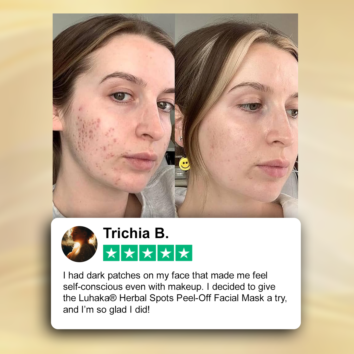 Luhaka® Herbal Spots Feel-off Facial Mask 2