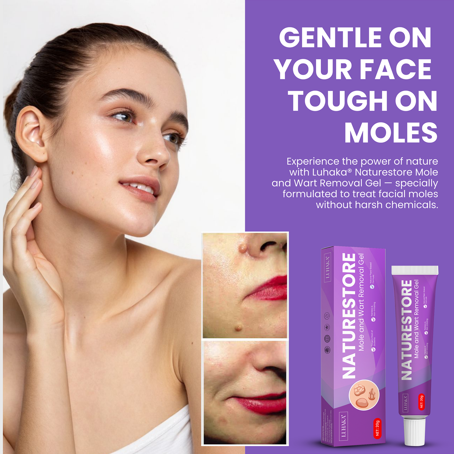 Luhaka® Naturestore Wart and Mole Removal Gel 🌟