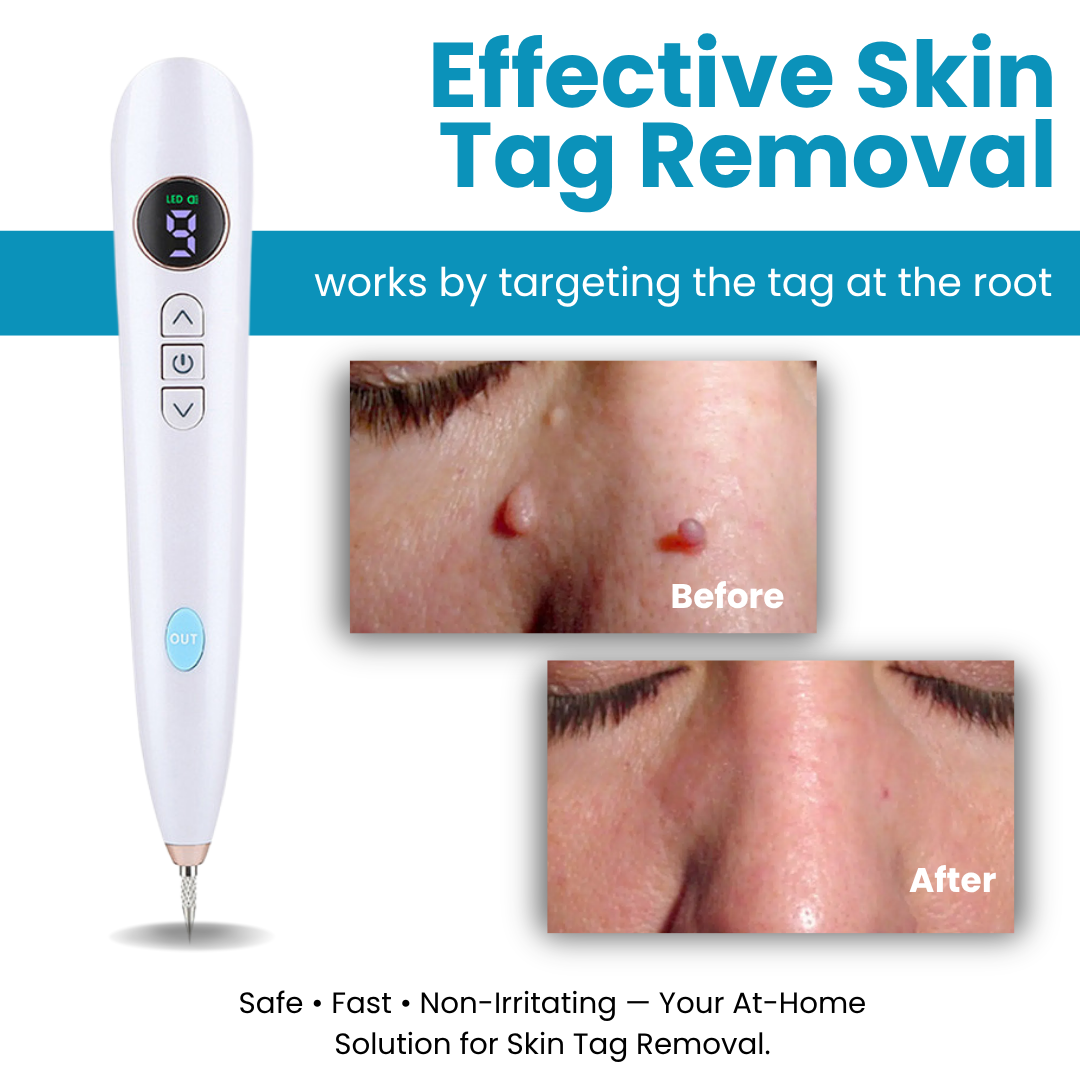 Dafeila® Shot Erase Pro 💎 1