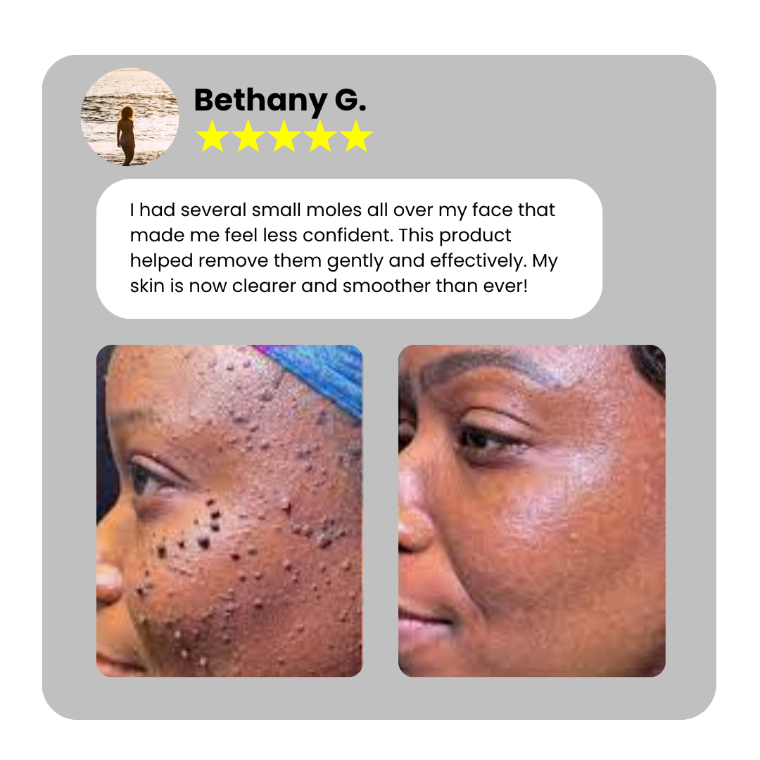 Dafeila® Shot Erase Pro 💎 1