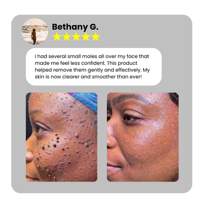 Dafeila® Shot Erase Pro 💎 1