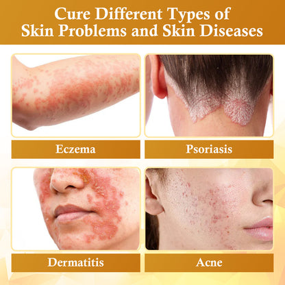 Luhaka® DermaFix Condense Mellifera Venom Skin Repairing Cream