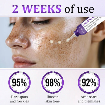 Luhaka® LumiDerma Anti-Hyperpigmentation Cream