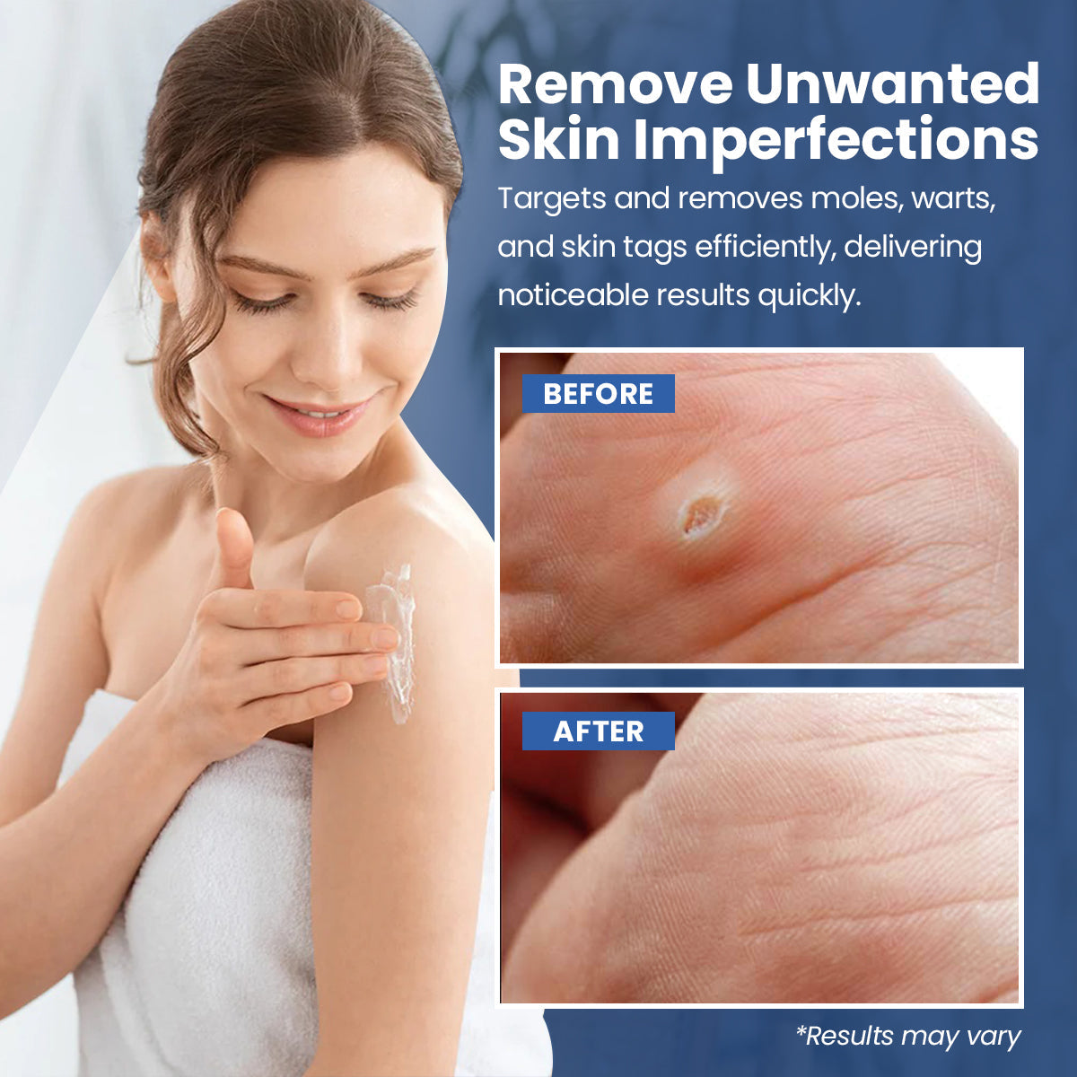 Luhaka® ClearWarts  Instant Blemish Removal Cream