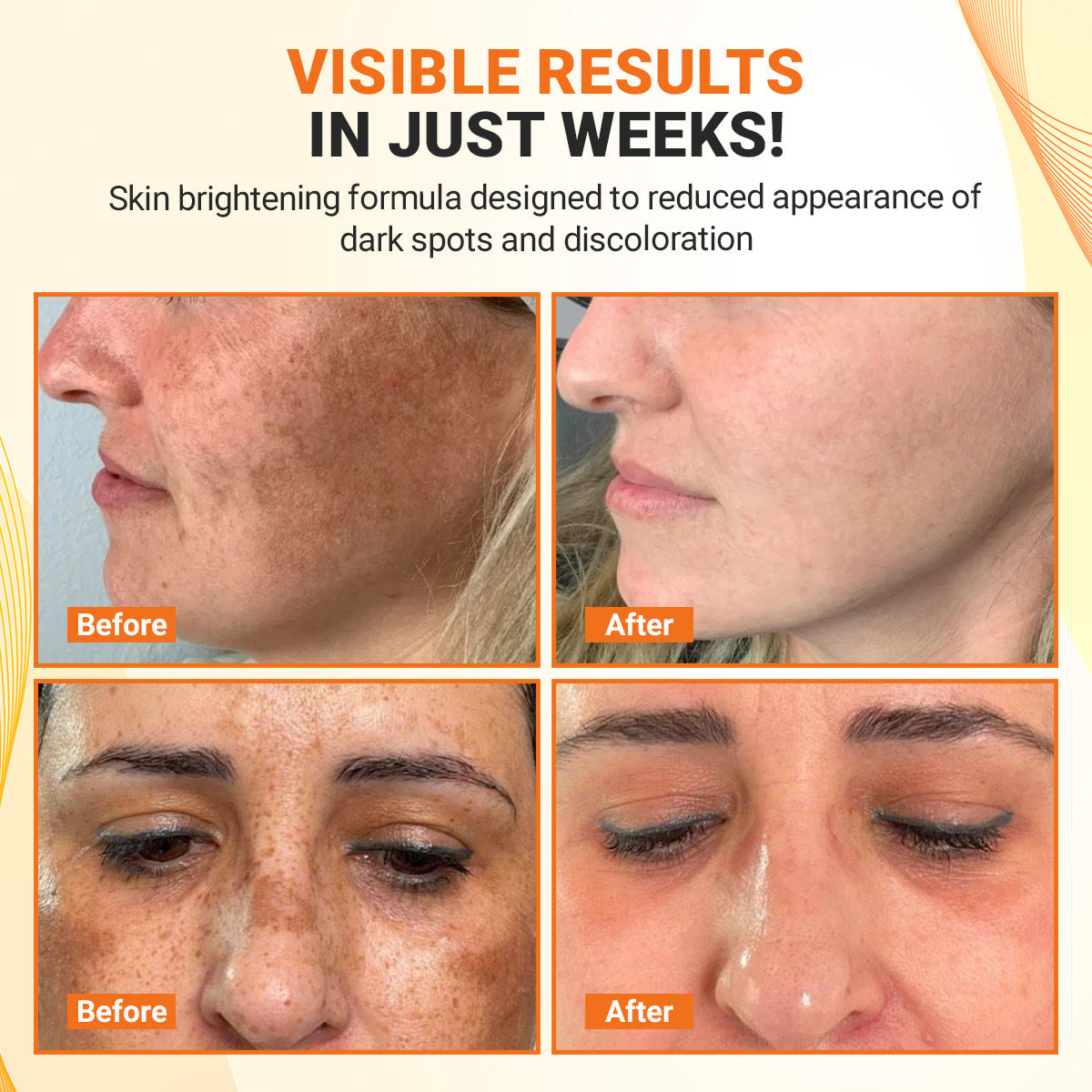 Luhaka® TripleAction Vitamin C Freckle Removal Cream ACE