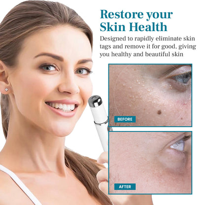 DAFEILA® LumeSkin Mole and Wart Removal Laser Pen 3