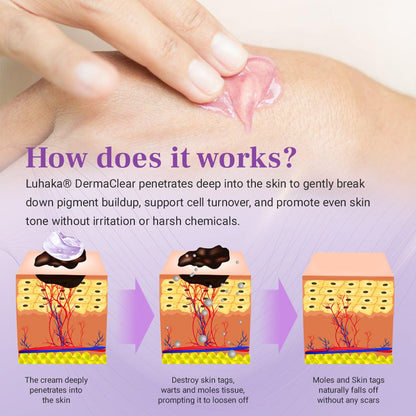 Luhaka® DermaClear Mole and Dark Spot Removal Bio-Gel_Ultra01