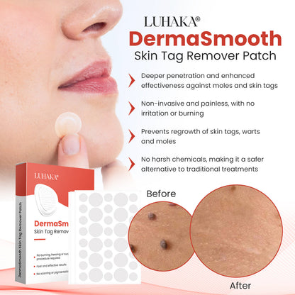 Luhaka® DermaSmooth Skin Tag Remover Patch_Ultra03