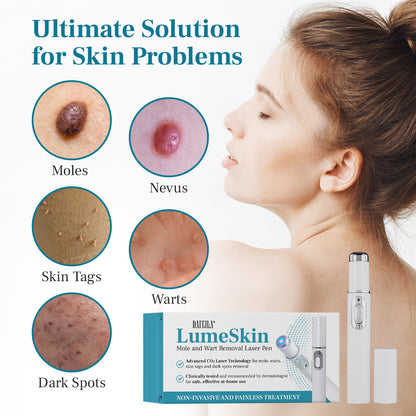 DAFEILA® LumeSkin Mole and Wart Removal Laser Pen 3