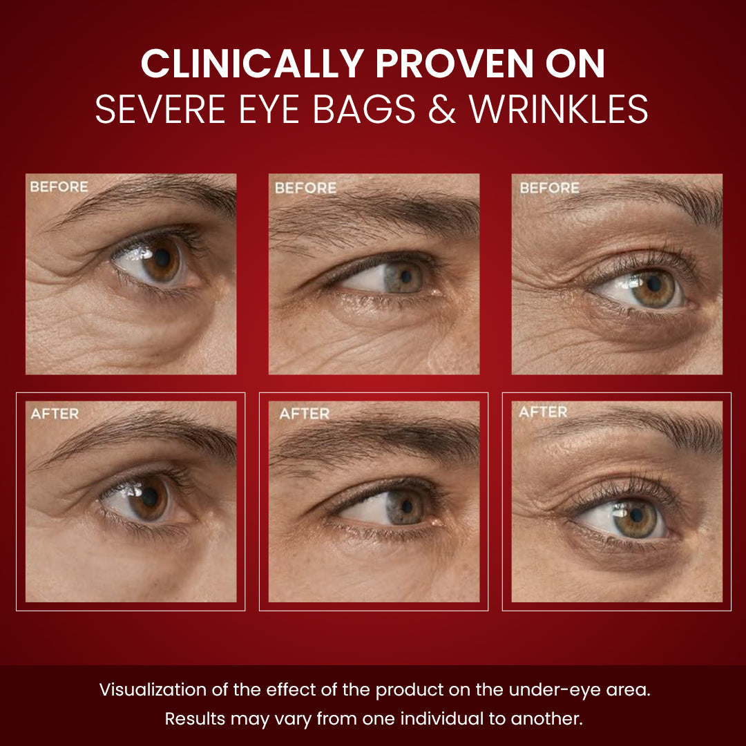 Luhaka® LumiLift Eye Bag Instant Eraser_Ultra01