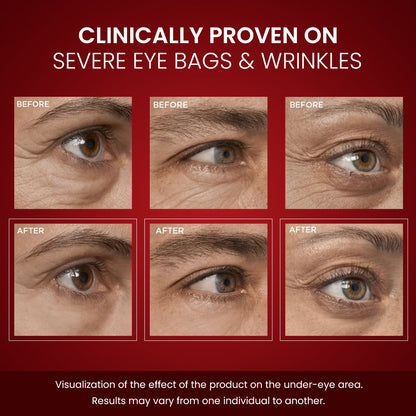 Luhaka® LumiLift Eye Bag Instant Eraser_Ultra01