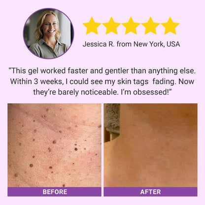 Luhaka® DermaClear Mole and Dark Spot Removal Bio-Gel_Ultra01