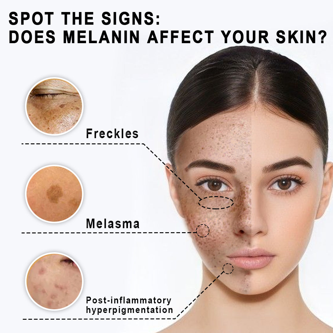 KISSHI™ Refinement Melanin Vanish Serum