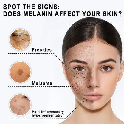 KISSHI™ Refinement Melanin Vanish Serum