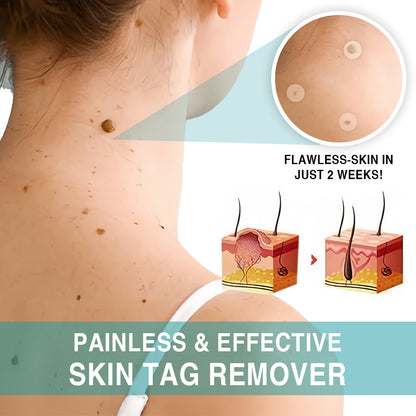 KISSHI™ WipeOffEase Blemish Treatment Patch