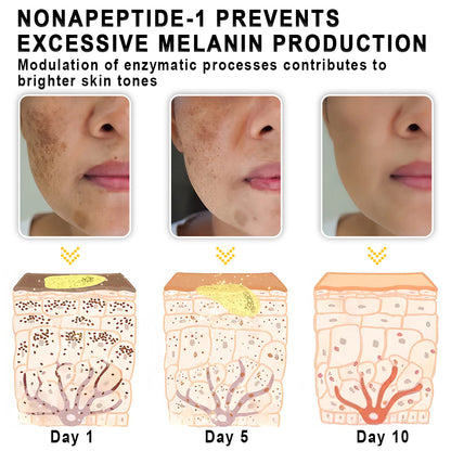 KISSHI™ Refinement Melanin Vanish Serum