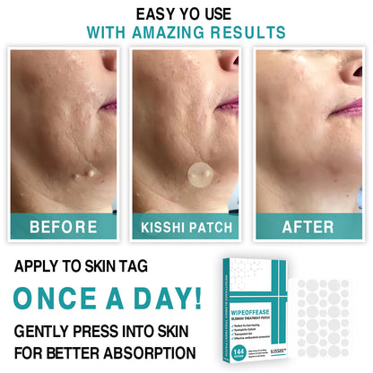 KISSHI™ WipeOffEase Blemish Treatment Patch
