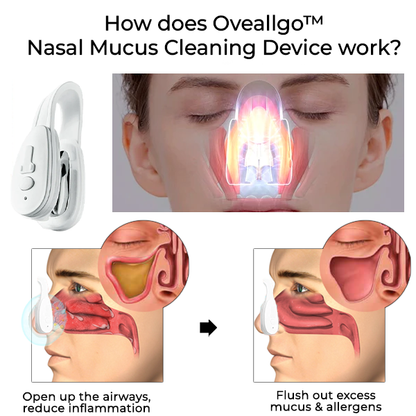 Oveallgo™ Nasal Mucus Cleaning Device