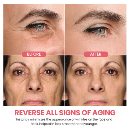 KISSHI™ Mini Microcurrent Facial Toning Device